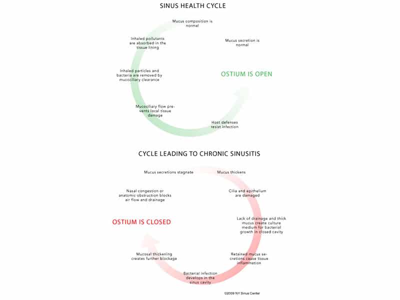 Sinus-health-Cycle-Infographic